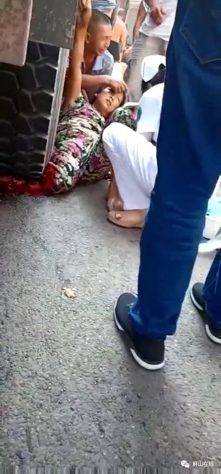 女子被货车碾压只剩腿图片