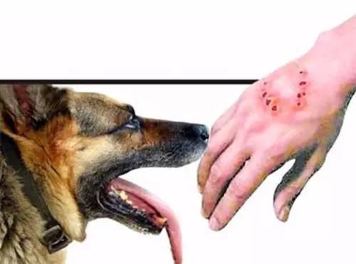 狂犬病发作伤口图片图片