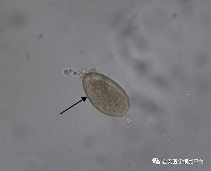 前后盘吸虫虫卵图片图片