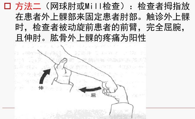 方法三:治疗方案:得了网球肘 ,如何治疗?