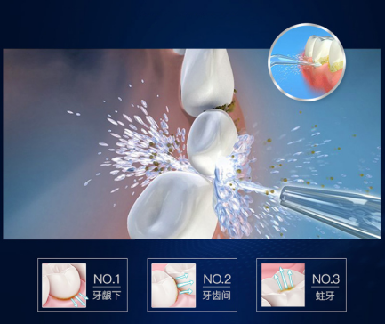 衝牙器有用嗎?想徹底清潔口腔縫隙你一定需要!