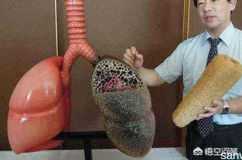 百草枯肺纤维化图片