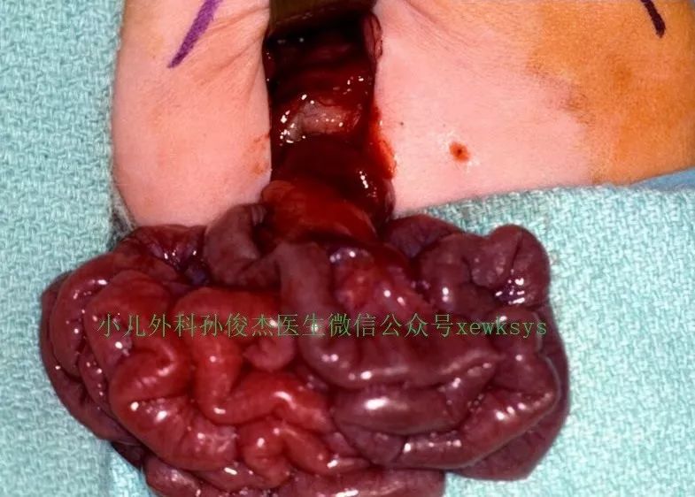 羊肠毒血症解剖图片图片