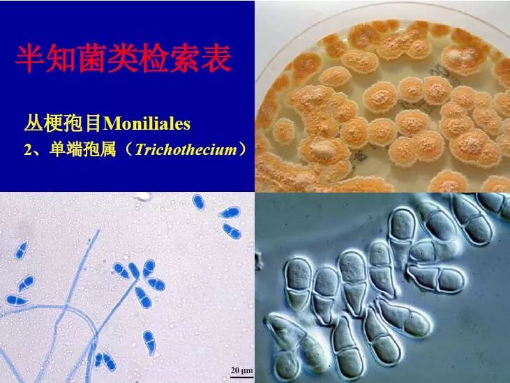 霉菌的种类图片