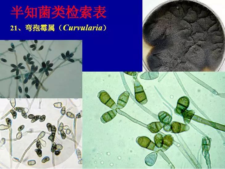 建议收藏常见霉菌分类鉴定