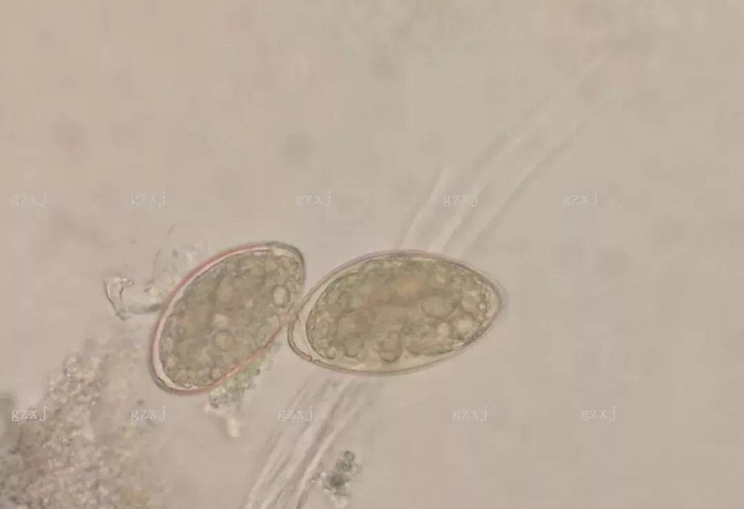 缩小膜壳绦虫卵图片图片