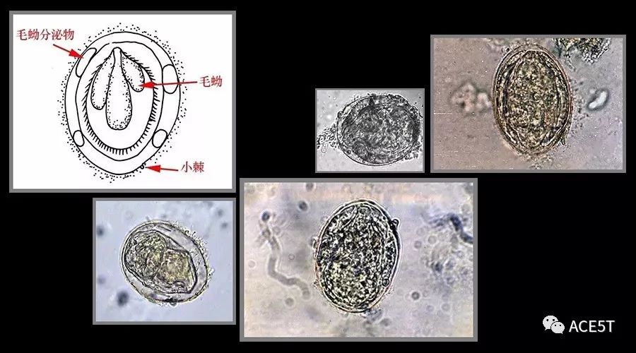 寄生虫形态·常见寄生虫卵