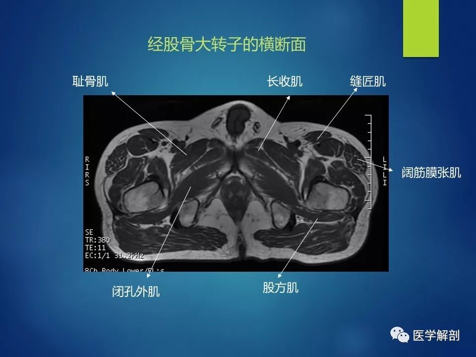 大腿肌肉核磁解剖图片