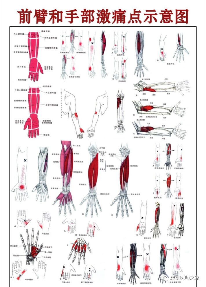 全身激痛点手册图片