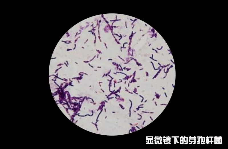 破伤风杆菌芽孢形态图片