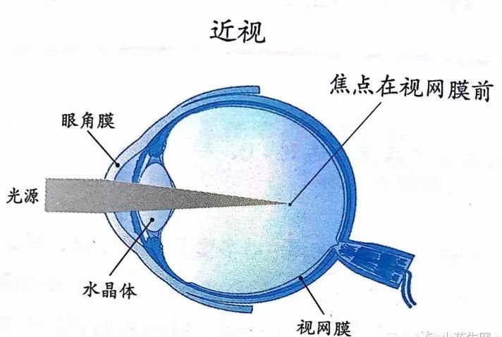 12,我的小孩是远视,视力是否不正常?