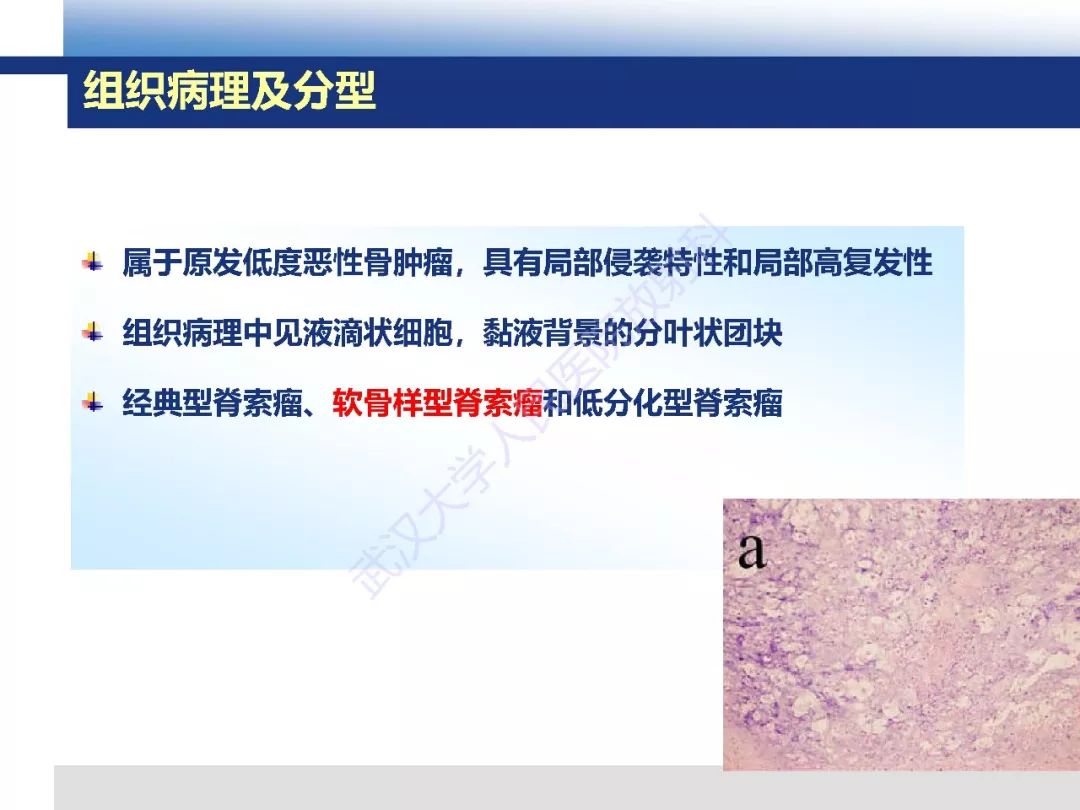 颅底软骨样脊索瘤影像诊断