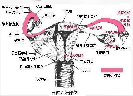 输卵管的位置图图片