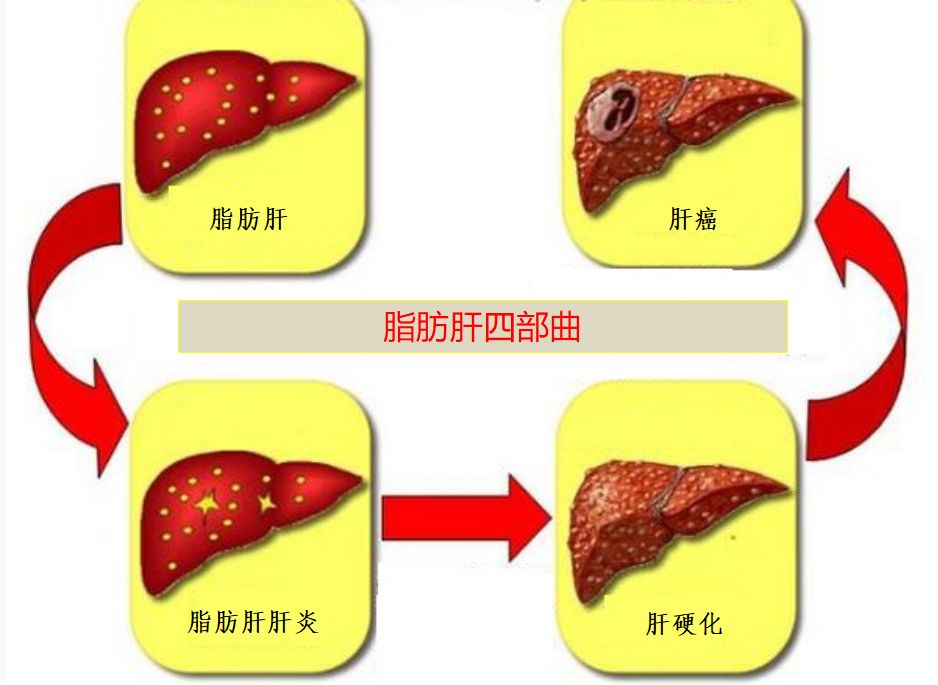 肝硬化保險可以理賠嗎 肝硬化可以投保的保險