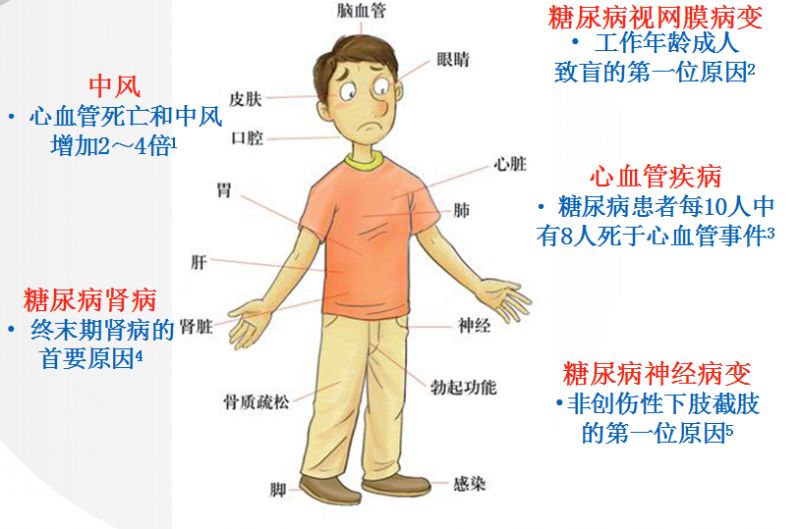 适度运动 科学治疗 