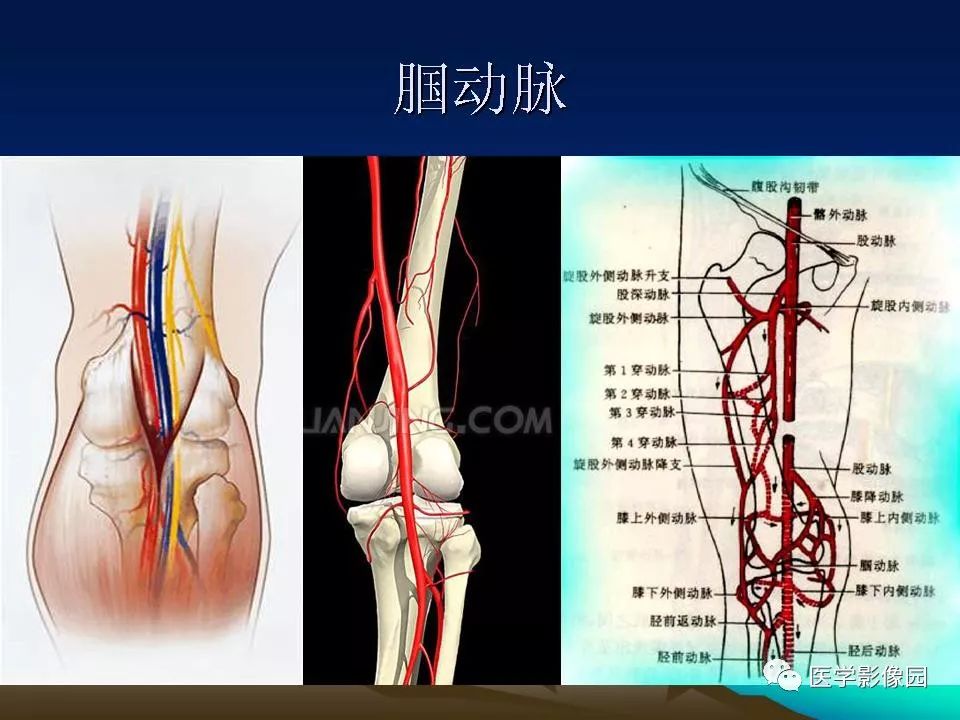 腘动脉位置图片图片