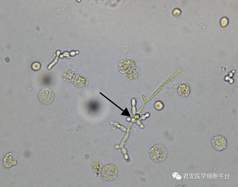 尿沉渣细菌图片
