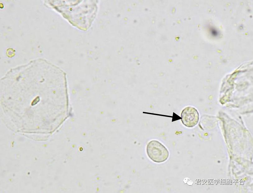 中层移行上皮细胞图片图片