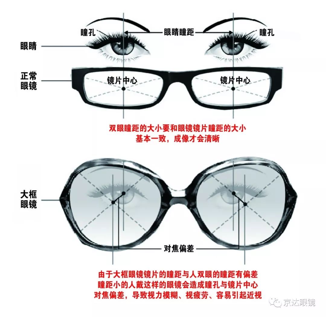旧眼镜测瞳距图解图片