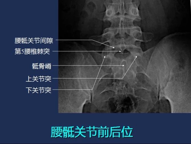 常規x線影像解剖大全