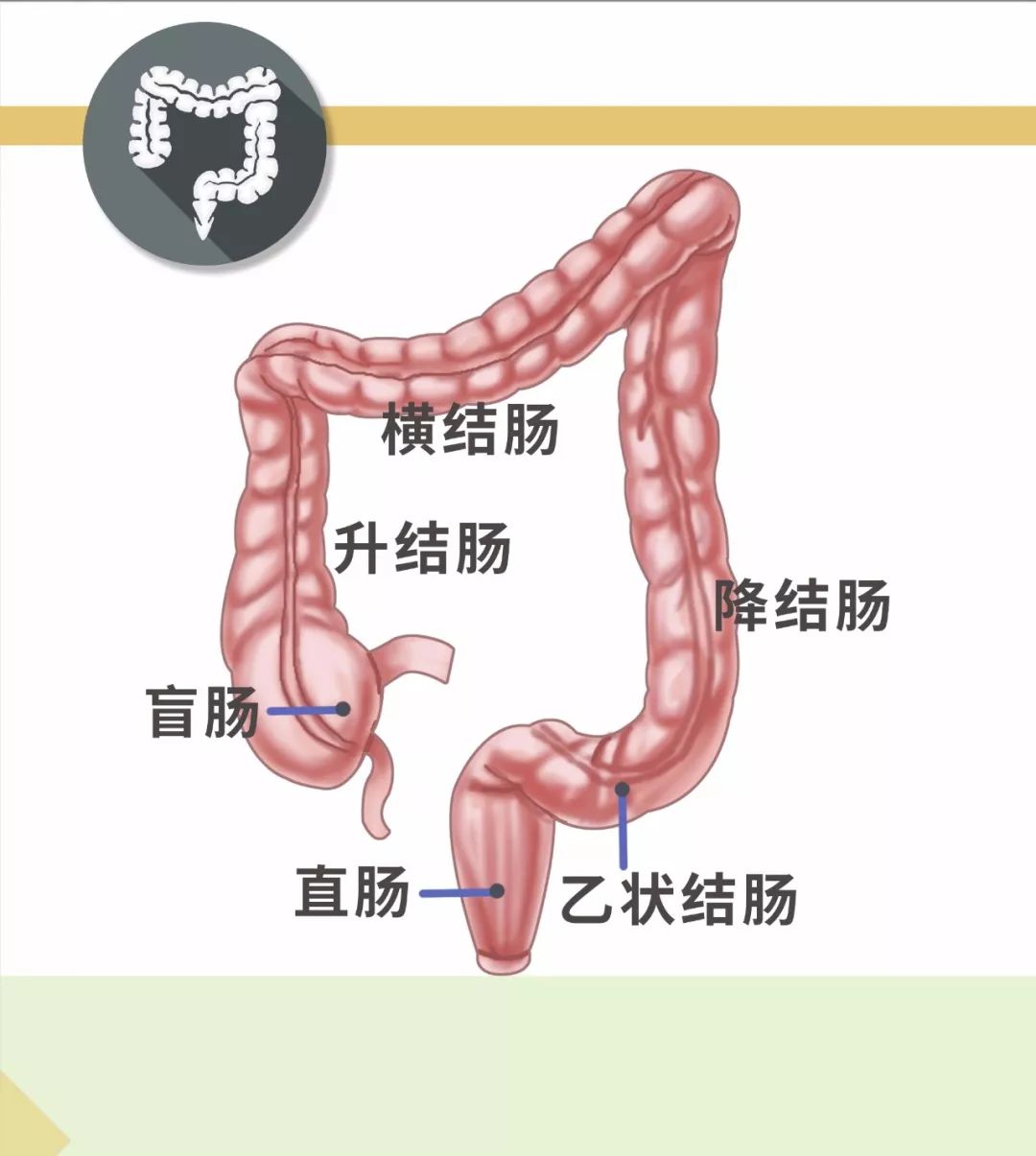 大肠癌好发部位图片