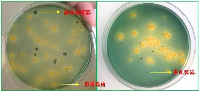 虾塘水体在培养基上进行检测,菌落呈现黄色的是哈维氏弧菌和溶藻弧菌