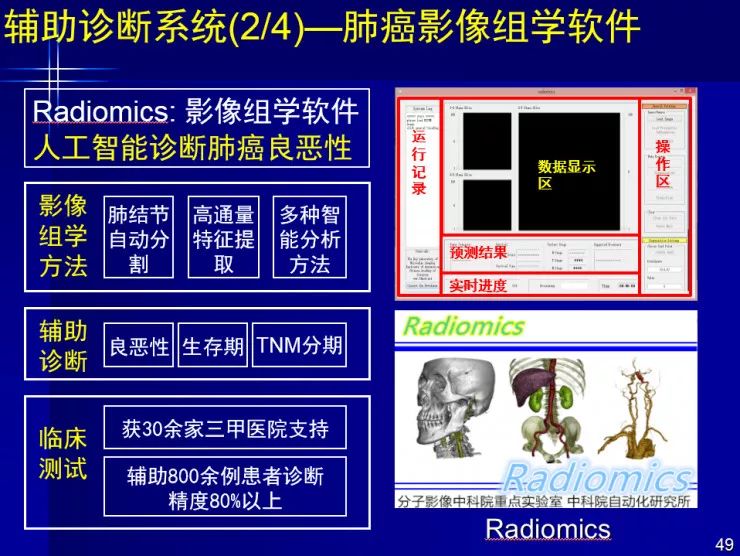 中科院田捷教授基于ai和医疗大数据的影像组学研究及其临床应用丨ccfg