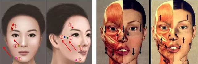 肉毒收紧下颌缘示意图图片