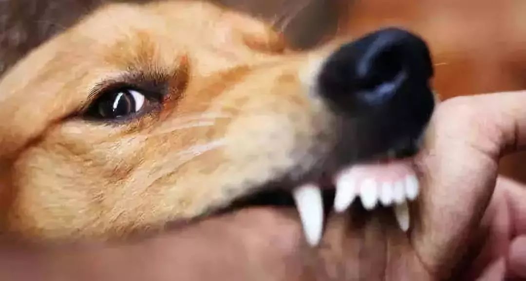 狗咬人表情图片搞笑图片