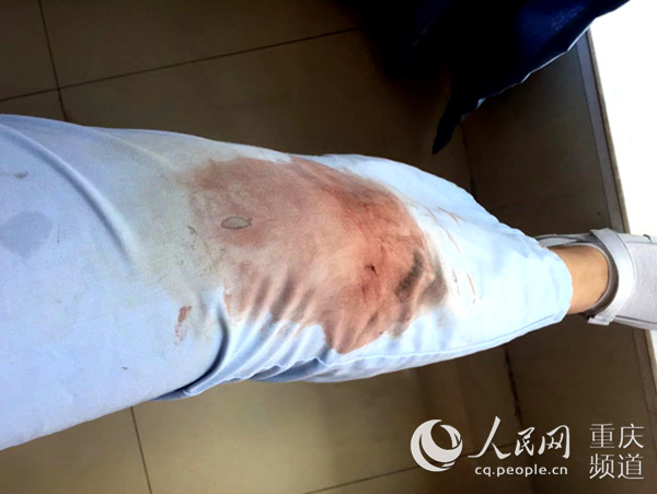 重庆:车祸现场女护士跪玻璃渣救人 感动朋友圈