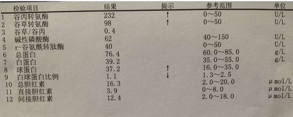 肝病醫生帶你看肝功能化驗單67血清轉氨酶丙氨酸氨基轉移酶(即谷丙