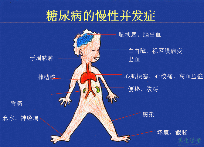 糖尿病有哪些症狀我們應該如何應對