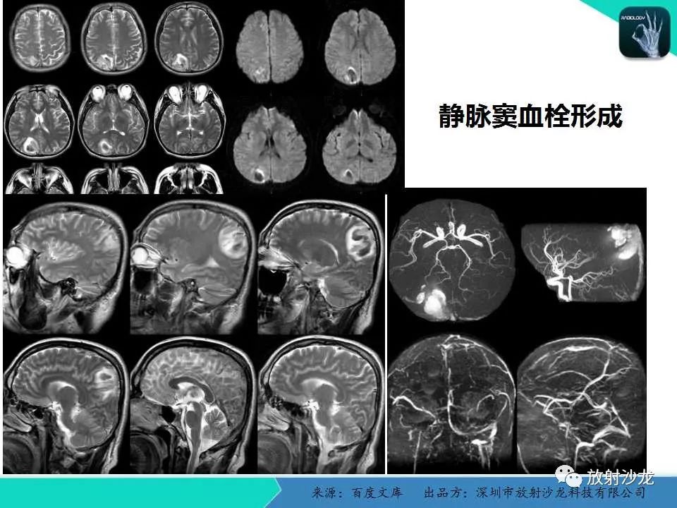 中,高級臨床影像科醫師合理選擇影像學檢查方法及閱片能力的案頭必備