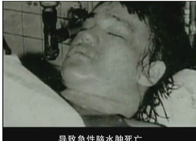 李小龙的妻子琳达首次公开李小龙死因真相,让众人大吃一惊!