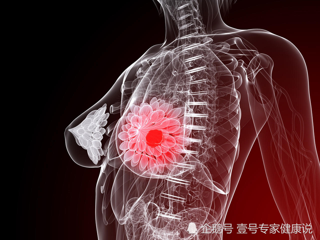 乳房出现这3个变化,虽然不痛不痒,但可能是乳腺癌警告