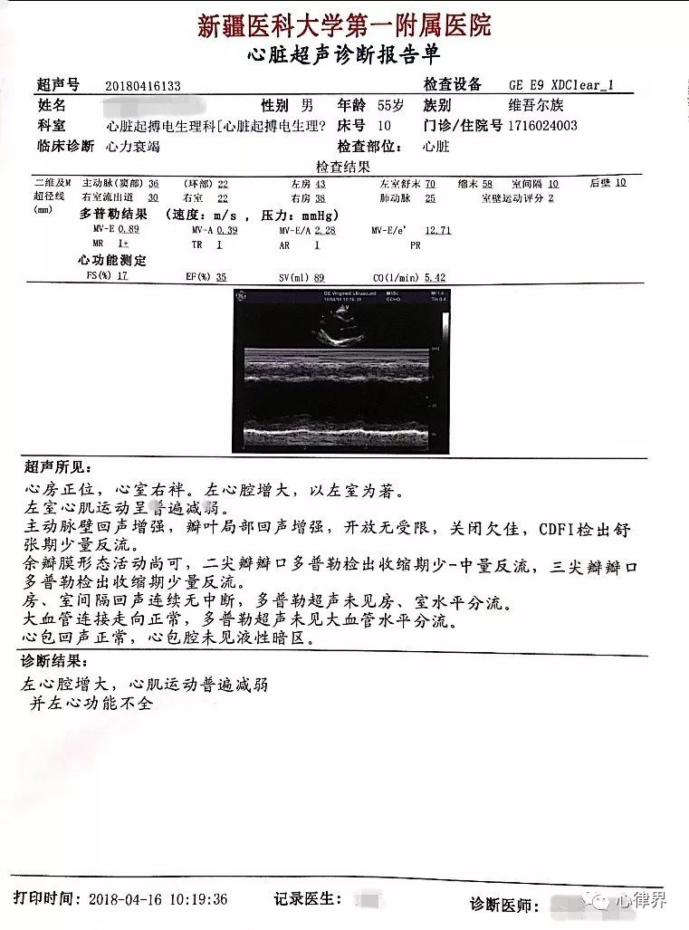 一次; 卡博平 50mg ,口服,每日三次; 長秀霖筆芯10單位睡前皮下注射