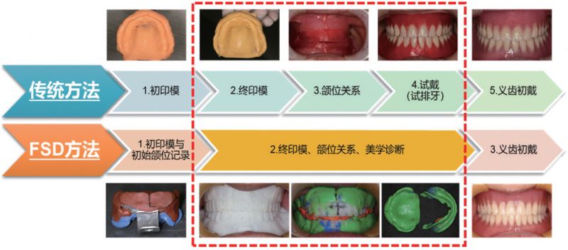 临床传统全口义齿制作需要经过初印模→终印模→颌位关系记录→义齿试