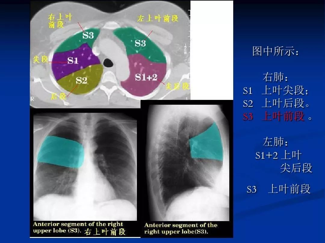 肺部正常ct阅片入门图片