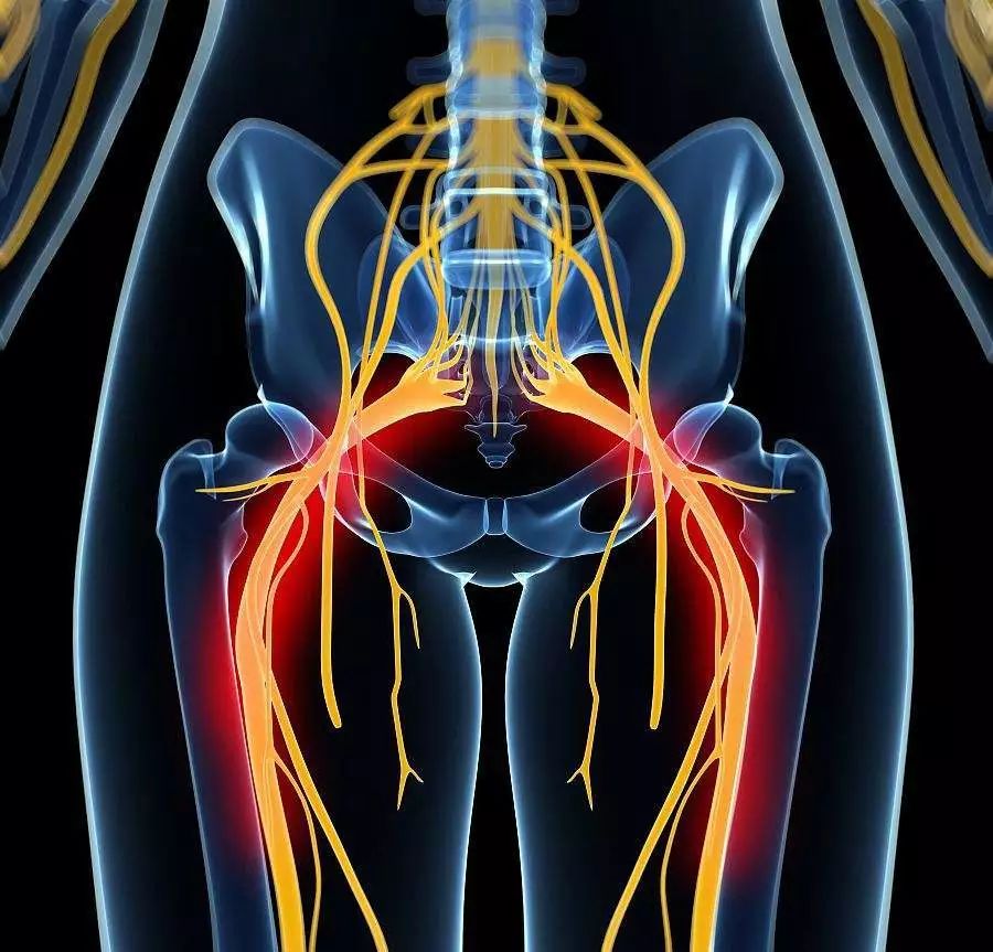 坐骨神经位置图片全图图片