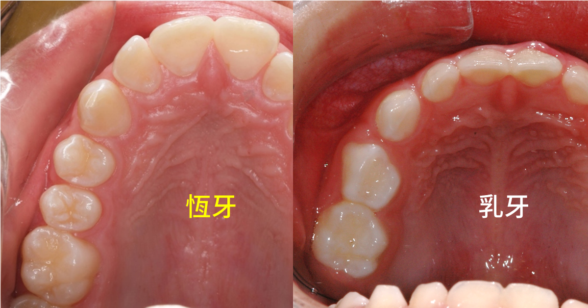 正常恒牙图片图片