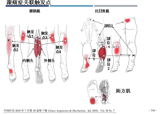 首届上海肌筋膜触发点mtrps技术初级研修班通知