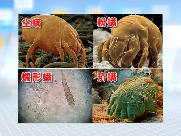 身体几乎小于1毫米 身体通常呈圆形或椭圆形 螨虫的种类很多 目前世界