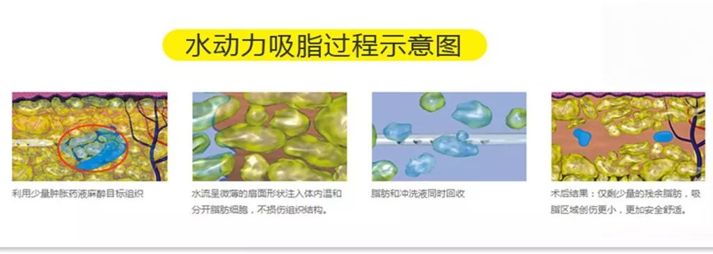 脂肪居然也有分类?想要高效率的减脂,减重,这些内容你需要了解一下!