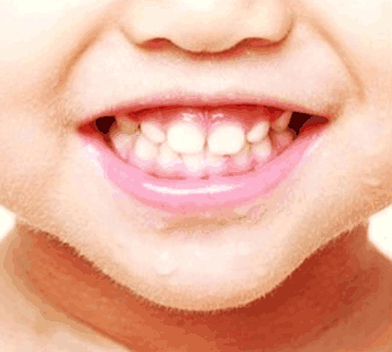 孩子换牙的时候, 吃哪些食物能让孩子长出的新牙既健康又美观?
