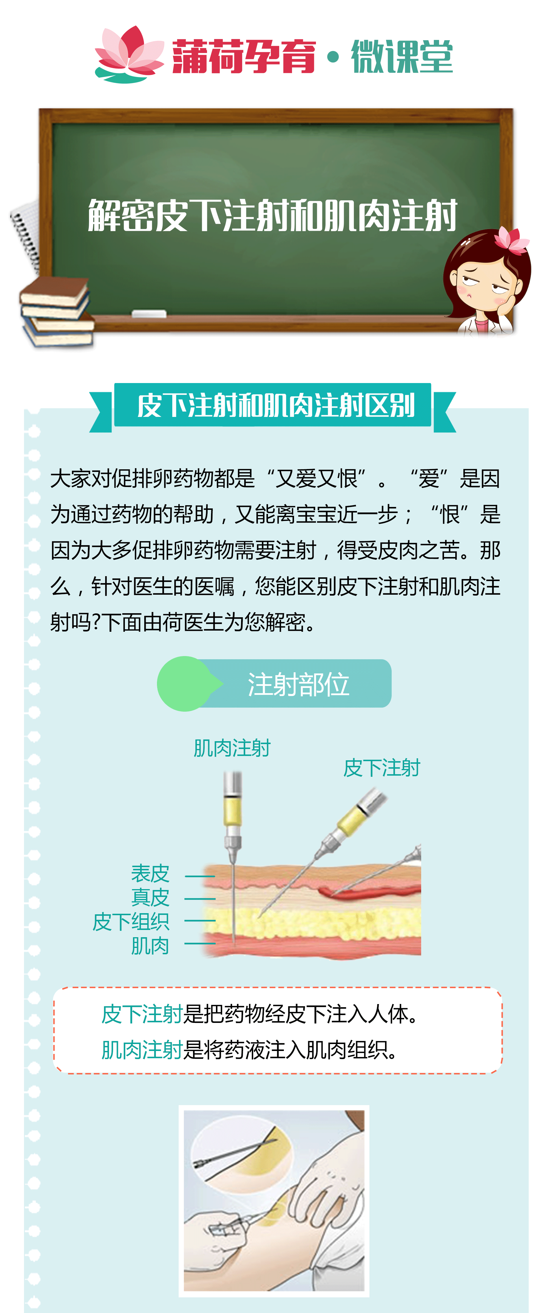 解密打促排针的皮下注射和肌肉注射