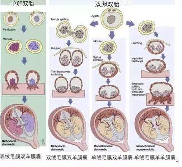 双胎要注意的绒毛膜性_羊膜