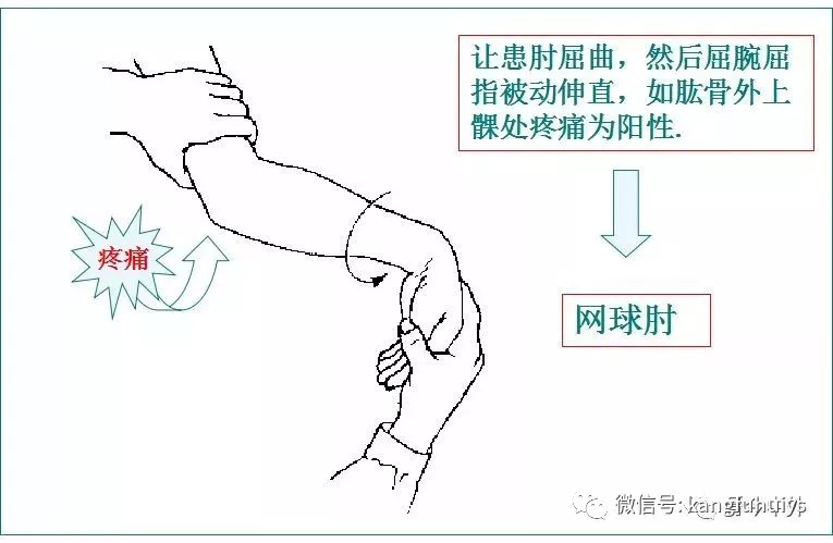 肱二头肌抗阻力试验图片