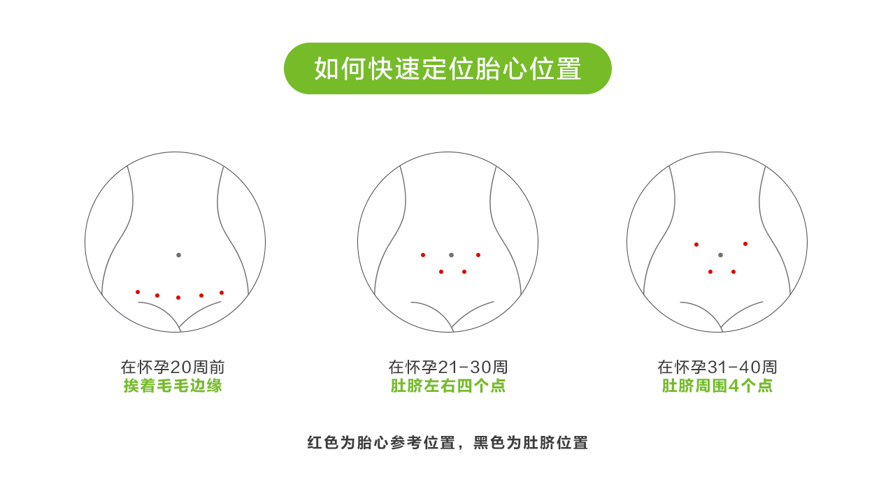 孕31周胎心位置图图片