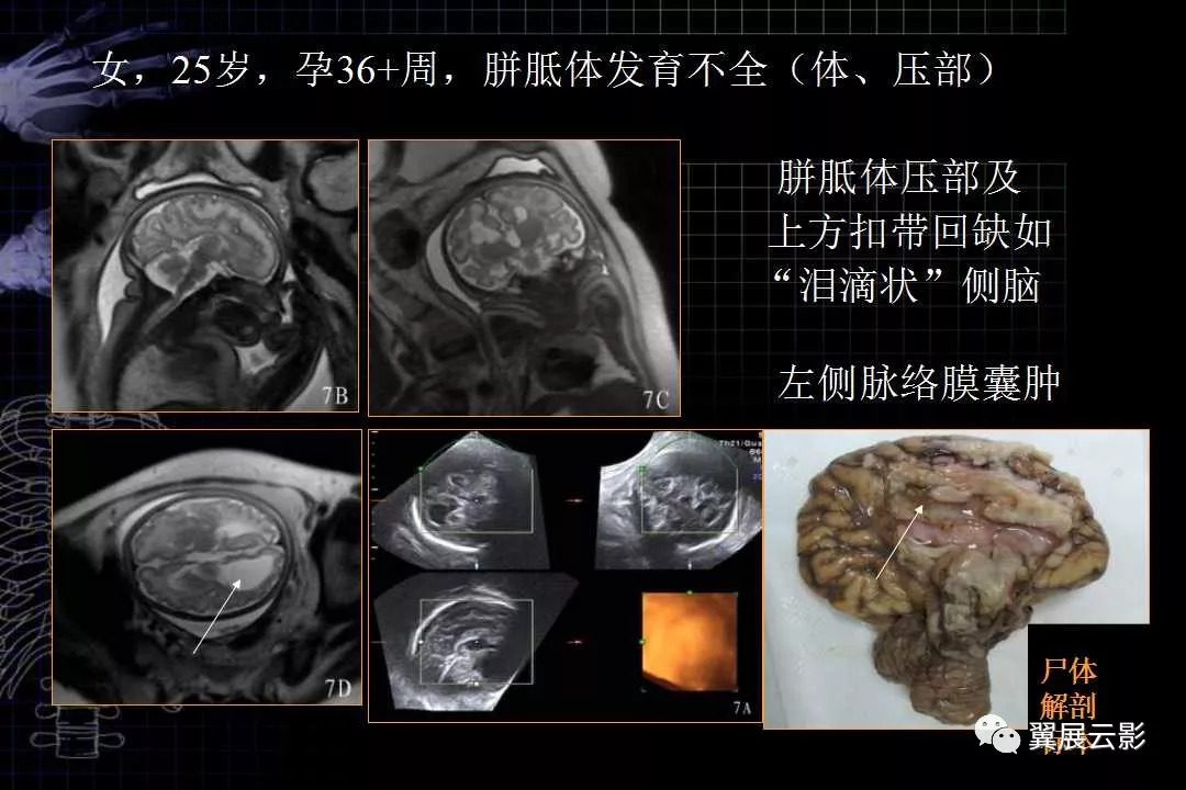 胎兒磁共振解剖圖譜