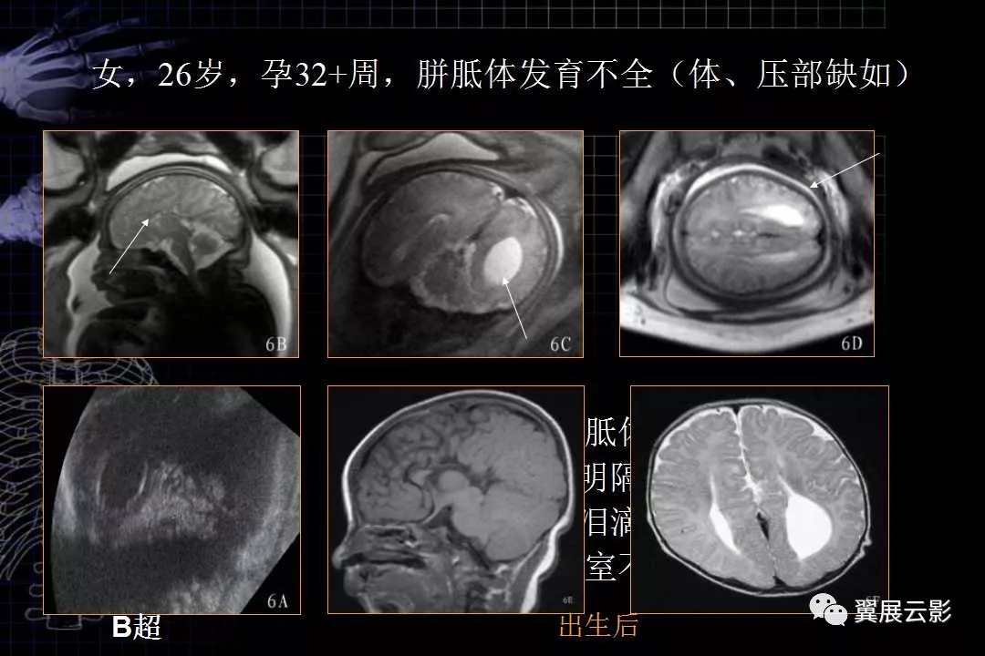 胎兒磁共振解剖圖譜